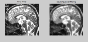 Application of Gaussian filter on a noisy image